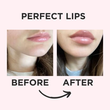 Lips & Intimate Areas Glow Enhancer